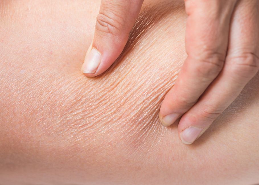 Loose Sagging Skin
