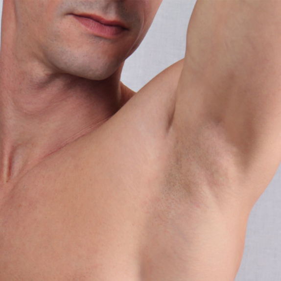 Anti Sweating Injections