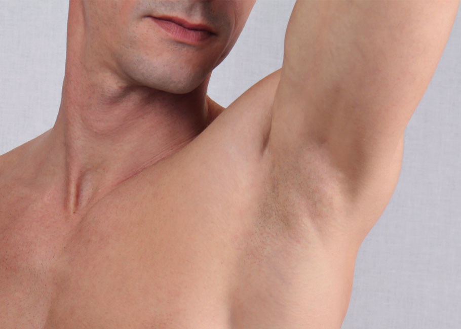 Anti Sweating Injections