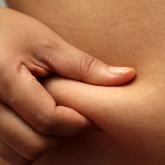 Excess Fat