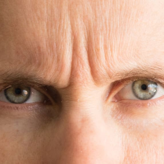 Frown Lines