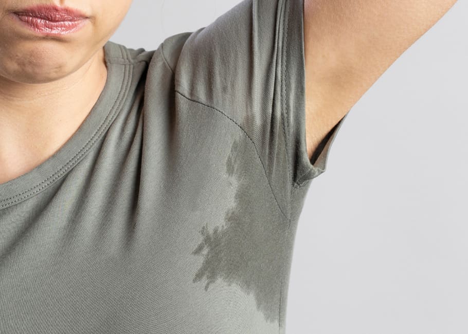 Excessive Sweating