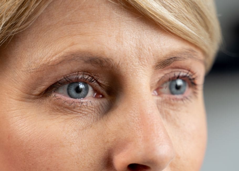 REFRACTIVE LENS EXCHANGE