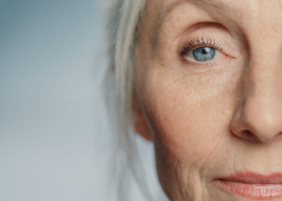 FS-CATARACT SURGERY