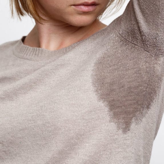 EXCESSIVE SWEATING