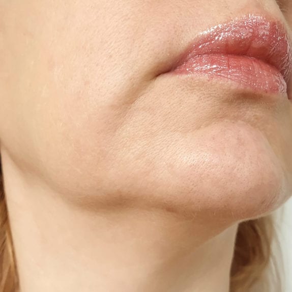 JOWLS