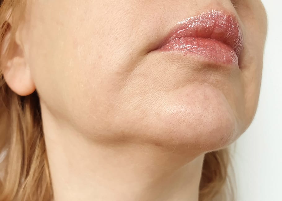 JOWLS