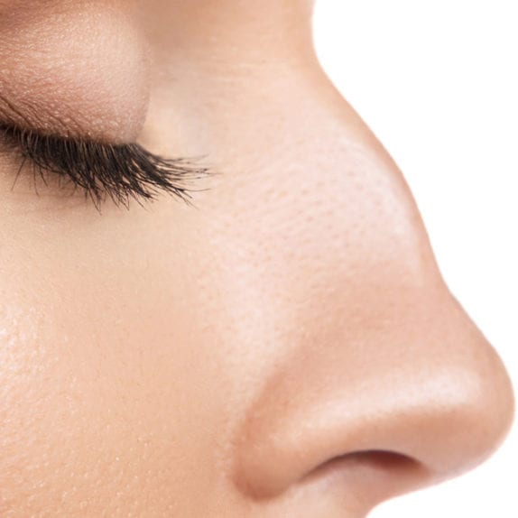 MIS-SHAPEN NOSE