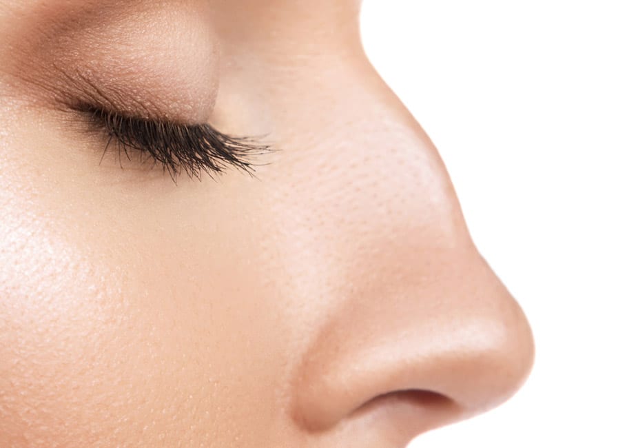 MIS-SHAPEN NOSE