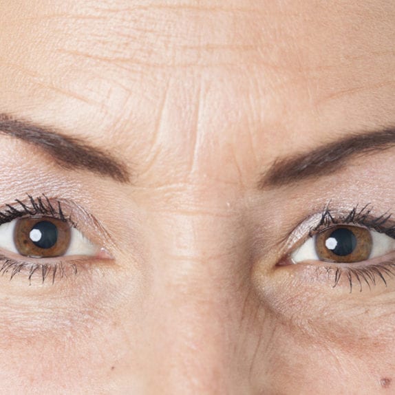 WRINKLES