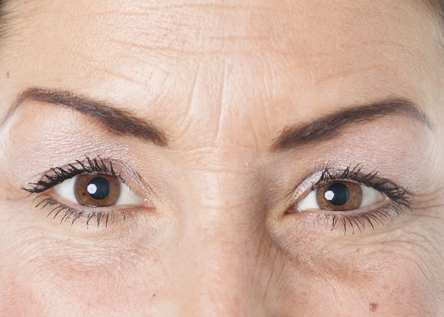 WRINKLES