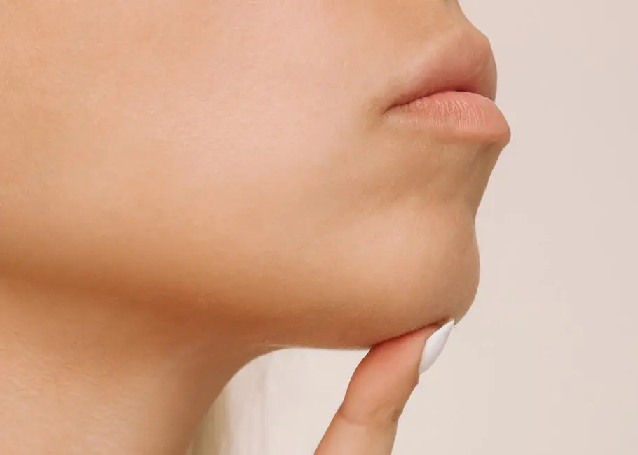 Chin Set Back