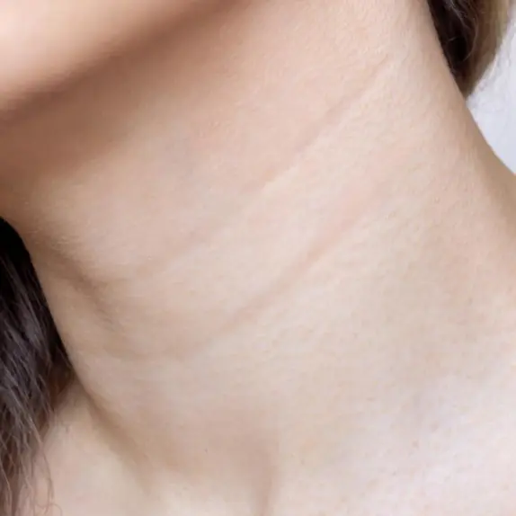 Neck Lines