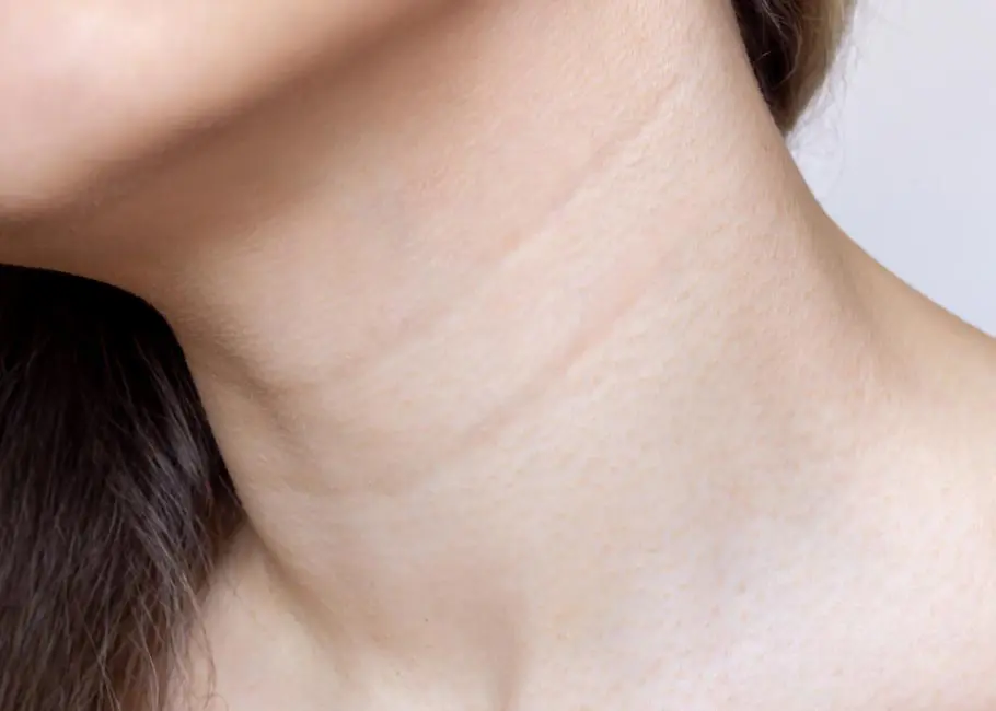 Neck Lines