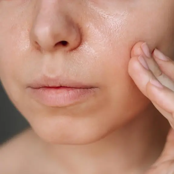 Oily Skin
