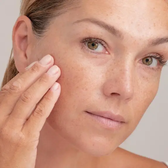 Pigmentation