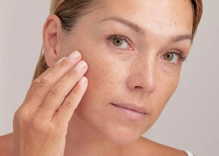 Pigmentation