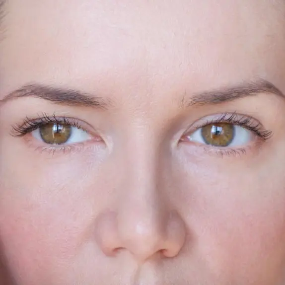 Profile Imbalance