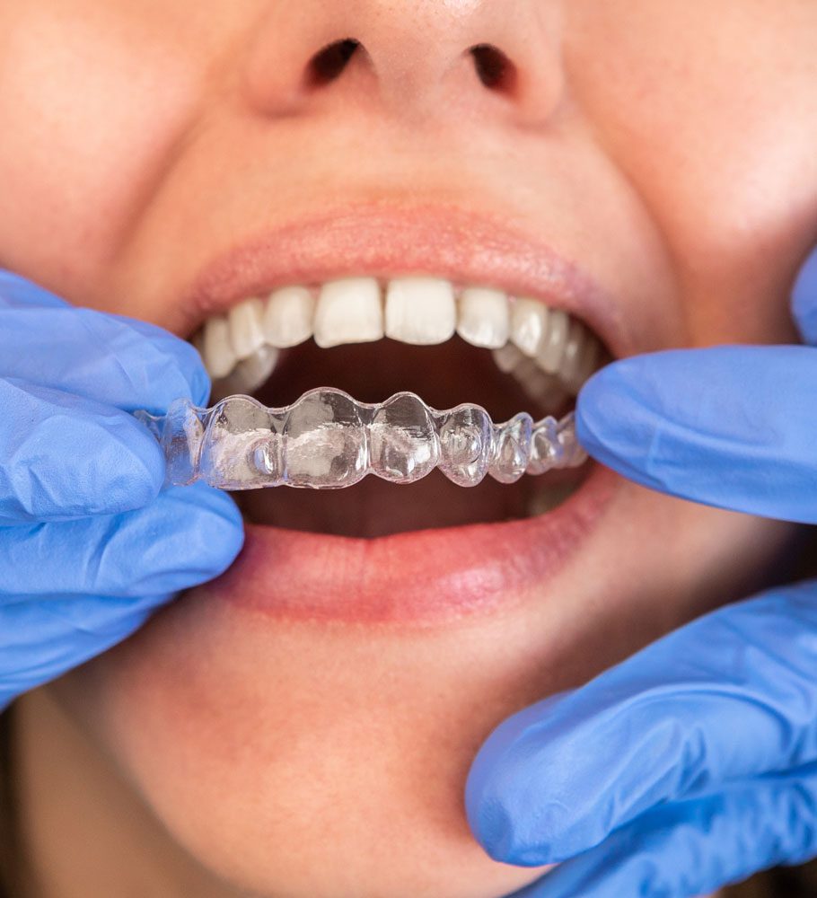Tunbridge Wells Orthodontics
